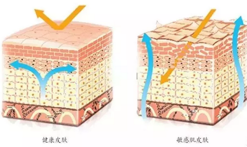 敏感肌膚與健康肌膚的對(duì)比，導(dǎo)致肌膚敏感的原因有哪些
