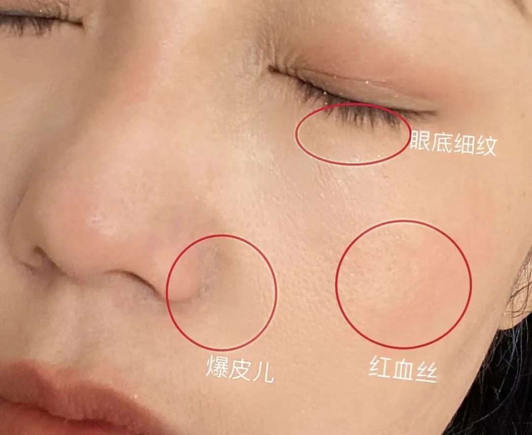 如何判斷自己是不是干敏肌膚？干敏肌有哪些特征？