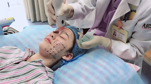 熱瑪吉有什么效果和副作用？