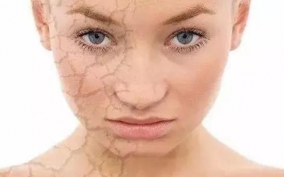 肌膚刺癢是什么原因？是哪些因素造成肌膚刺癢的現(xiàn)象？