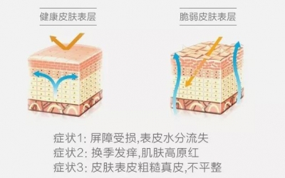 敏感肌與過敏肌的區(qū)別是什么？