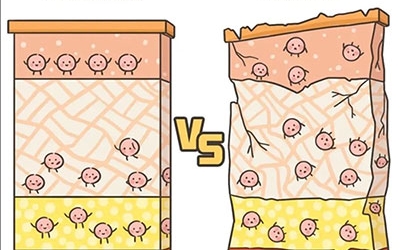 敏感性皮膚產(chǎn)生的原因是什么？